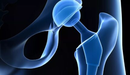 defective-product-banner